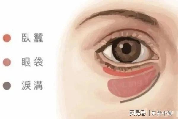 眼袋切除手術(shù)費用詳解，價格因素與如何選擇合適的手術(shù)方案，眼袋切除手術(shù)費用解析，了解價格因素與選擇最佳手術(shù)方案