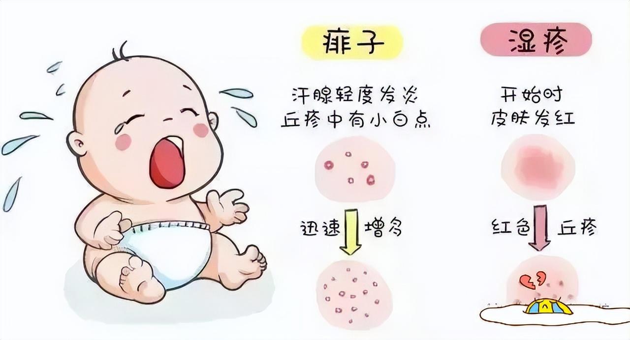 痱子和濕疹的區(qū)別，深入了解兩種常見皮膚狀況，痱子和濕疹的區(qū)別，常見皮膚狀況詳解